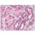 Kidney: Formalin-Fixed Paraffin-Embedded (FFPE)