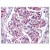 Kidney: Formalin-Fixed Paraffin-Embedded (FFPE)