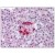 Pancreas: Formalin-Fixed Paraffin-Embedded (FFPE)