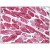 Heart: Formalin-Fixed Paraffin-Embedded (FFPE)