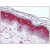 Skin: Formalin-Fixed Paraffin-Embedded (FFPE)
