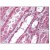 Kidney: Formalin-Fixed Paraffin-Embedded (FFPE)