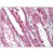 Kidney: Formalin-Fixed Paraffin-Embedded (FFPE)
