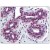 AP08473PU-N CD262 antibody staining of Formalin-Fixed Paraffin-Embedded Human Breast at 10 µg/ml.
