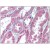 Kidney: Formalin-Fixed Paraffin-Embedded (FFPE)