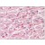 Heart: Formalin-Fixed Paraffin-Embedded (FFPE)