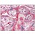 Placenta: Fromalin-Fixed Paraffin-Embedded (FFPE)