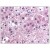 AM06000PU-N Interleukin-25 antibody staining of Formalin-Fixed Paraffin-Embedded Human Adrenal cortex at 10 µg/ml followed by biotinylated anti-Mouse IgG secondary antibody, Alkaline Phosphatase-Streptavidin and Chromogen.