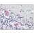 Brain, cerebellum: Formalin-Fixed Paraffin-Embedded (FFPE)
