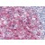 Tonsil: Formalin-Fixed, Paraffin-Embedded (FFPE)