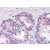 Prostate: Formalin-Fixed, Paraffin-Embedded (FFPE)