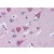 Brain, cortex: Formalin-Fixed, Paraffin-Embedded (FFPE)