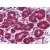 Breast: Formalin-Fixed, Paraffin-Embedded (FFPE)