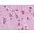 Brain, cortex: Formalin-Fixed, Paraffin-Embedded (FFPE)