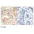 Figure 1. Immunohistochemical analysis of paraffin-embedded human breast carcinoma tissue using CDK6 pTyr13 Antibody (#AP09488PU).