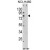 Western blot analysis of ACSS3 Antibody (Center) (AP17866PU-N) in NCI-H460 cell line lysates (35ug/lane). ACSS3 (arrow) was detected using the purified Pab.(2ug/ml)