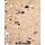 Formalin-fixed and paraffin-embedded human brain tissue with UNC5C Antibody (Center), which was peroxidase-conjugated to the secondary antibody, followed by DAB staining.