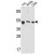 Western blot analysis of SAP Antibody (Center E300) (AP17729PU-N) in Y79,A2058,CEM cell line lysates(35ug/lane). SAP (arrow) was detected using the purified Pab.