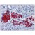 Pancreas: Formalin-Fixed, Paraffin-Embedded (FFPE)