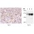 Figure 1. AM05219AF-N CDC25A antibody staining of Paraffin Embedded Human Tonsil Section (germinal center).
Figure 2. Western blot analysis of CDC25A expression in Hela cells (Lane 1), NIH/3T3 cells (Lane 2) and Rat-1 cells (Lane 3) using CDC25A antibody (AM05219AF-N).