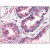 Immunohistochemistry: AP20076PU-N GPR126 antibody staining of Formalin-Fixed, Paraffin-Embedded Human Prostate.