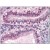 Immunohistochemistry: AM09062PU-N CRABP2 antibody staining of Formalin-Fixed, Paraffin-Embedded Human Uterus at 10 µg/ml followed by biotinylated anti-Mouse IgG secondary antibody, alkaline phosphatase-streptavidin and chromogen.