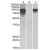 HEK293 lysate (10 µg protein in RIPA buffer) overexpressing Human PCSK9 with C-terminal MYC tag probed with AP22408PU-N (1 µg/ml) in Lane A and probed with anti-MYC Tag (1/1000) in lane C. Mock-transfected HEK293 probed with AP22408PU-N (1mg/ml) in Lane B. Primary incubations were for 1 hour. Detected by chemiluminescence.