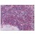 Human Spleen: Formalin-Fixed, Paraffin-Embedded (FFPE)
