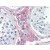 IHC Image for AP22651PU-N
Human Testis (formalin-fixed, paraffin-embedded) stained with Laminin antibody AP22651PU-N at 5 µg/ml followed by biotinylated goat anti-rabbit IgG secondary antibody LS-D1, alkaline phosphatase-streptavidin and chromogen.