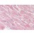 Human Heart (formalin-fixed, paraffin-embedded) stained with CASP1 antibody AP22860PU-N at 5 µg/ml followed by biotinylated goat anti-rabbit IgG secondary antibody, alkaline phosphatase-streptavidin and chromogen.