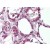 Human Thyroid (formalin-fixed, paraffin-embedded) stained with MRGPRF antibody AP22836PU-N at 10 µg/ml followed by biotinylated goat anti-rabbit IgG secondary antibody, alkaline phosphatase-streptavidin and chromogen.