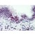 Human Lung (formalin-fixed, paraffin-embedded) stained with CASZ1 antibody AP22621PU-N at 5 µg/ml followed by biotinylated goat anti-rabbit IgG secondary antibody, alkaline phosphatase-streptavidin and chromogen.