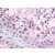 Human Testis (formalin-fixed, paraffin-embedded) stained with RANGAP1 antibody AP22630SU-N at 1/100 followed by biotinylated goat anti-rabbit IgG secondary antibody, alkaline phosphatase-streptavidin and chromogen.