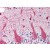 Human Brain, Cerebellum (formalin-fixed, paraffin-embedded) stained with SNCG antibody AP22638PU-N at 5 µg/ml followed by biotinylated goat anti-rabbit IgG secondary antibody, alkaline phosphatase-streptavidin and chromogen.