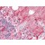 Human Brain, Cerebellum (formalin-fixed, paraffin-embedded) stained with SLITRK1 antibody AP22669PU-N at 5 µg/ml followed by biotinylated goat anti-rabbit IgG secondary antibody, alkaline phosphatase-streptavidin and chromogen.