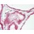 Human Thyroid (formalin-fixed, paraffin-embedded) stained with SLITRK4 antibody AP22671PU-N at 5 µg/ml followed by biotinylated goat anti-rabbit IgG secondary antibody, alkaline phosphatase-streptavidin and chromogen.