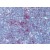 Human Thymus (formalin-fixed, paraffin-embedded) stained with SENP1 antibody AP22748PU-N followed by biotinylated goat anti-rabbit IgG secondary antibody, alkaline phosphatase-streptavidin and chromogen.