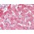 Human Liver (formalin-fixed, paraffin-embedded) stained with ALDH2 antibody AP22751PU-N followed by biotinylated goat anti-rabbit IgG secondary antibody, alkaline phosphatase-streptavidin and chromogen.