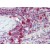 Human Spleen (formalin-fixed, paraffin-embedded) stained with PIM3 antibody AP22788PU-N followed by biotinylated goat anti-rabbit IgG secondary antibody, alkaline phosphatase-streptavidin and chromogen.