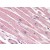 Human Heart (formalin-fixed, paraffin-embedded) stained with CASP1 antibody AP22861PU-N at 5 µg/ml followed by biotinylated goat anti-rabbit IgG secondary antibody, alkaline phosphatase-streptavidin and chromogen.
