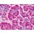Human Pancreas: Formalin-Fixed, Paraffin-Embedded (FFPE)