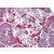 Human Pancreas: Formalin-Fixed, Paraffin-Embedded (FFPE)