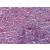 Human Spleen: Formalin-Fixed, Paraffin-Embedded (FFPE)
