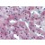 Human Adrenal: Formalin-Fixed, Paraffin-Embedded (FFPE)