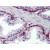 Human Prostate: Formalin-Fixed, Paraffin-Embedded (FFPE)