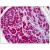Human Pancreas: Formalin-Fixed, Paraffin-Embedded (FFPE)