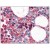 Human Bone Marrow: Formalin-Fixed, Paraffin-Embedded (FFPE)
