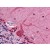 Human Brain, Cerebellum: Formalin-Fixed, Paraffin-Embedded (FFPE)