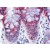 Human Colon: Formalin-Fixed, Paraffin-Embedded (FFPE)