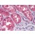 Human Kidney: Formalin-Fixed, Paraffin-Embedded (FFPE)